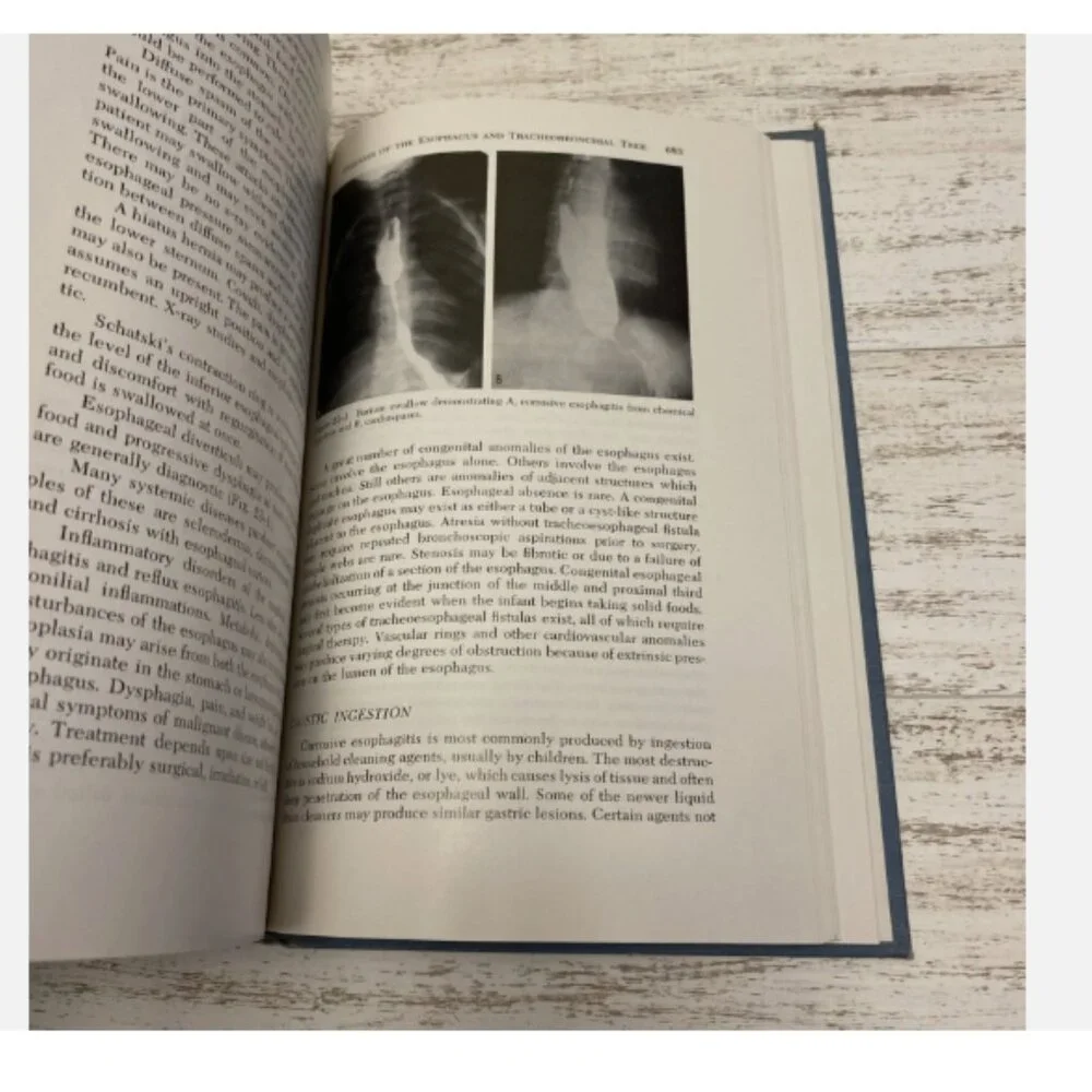 FUNDAMENTALS OF OTOLARYNGOLOGY Boies’s Adams Papaella 1978 Hardcover